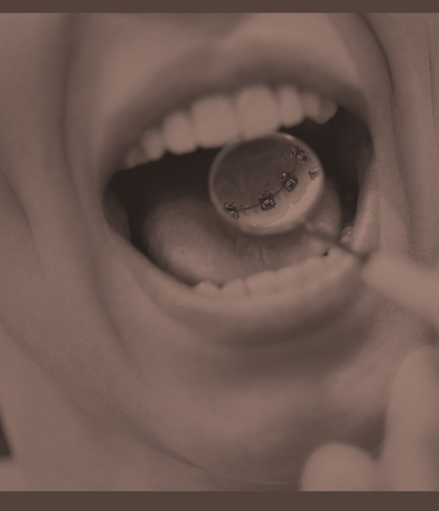 Treatment Image 1