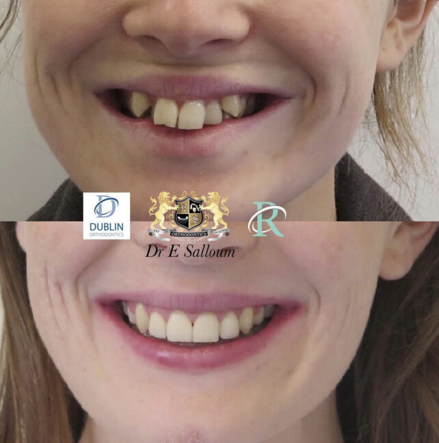 Before - Dr Erfan Salloum