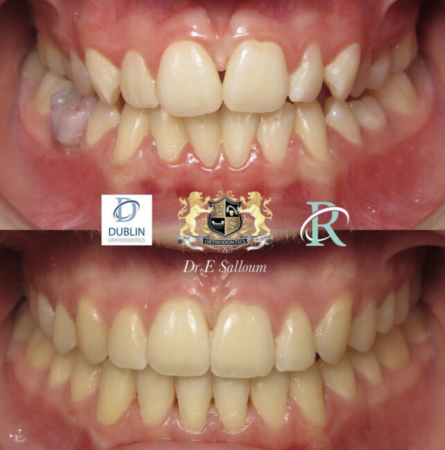 Before - Dr Erfan Salloum