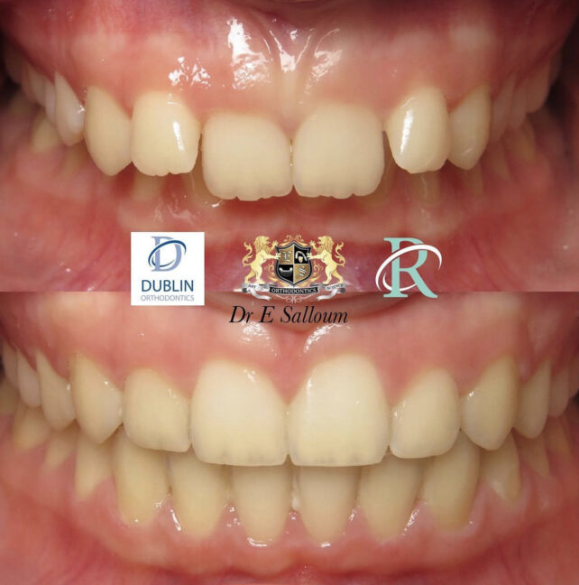 Before - Dr Erfan Salloum