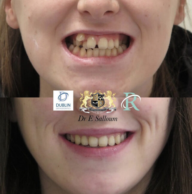 Before - Dr Erfan Salloum