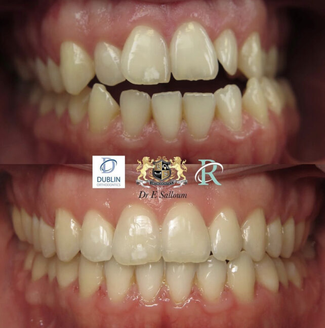 Before - Dr Erfan Salloum