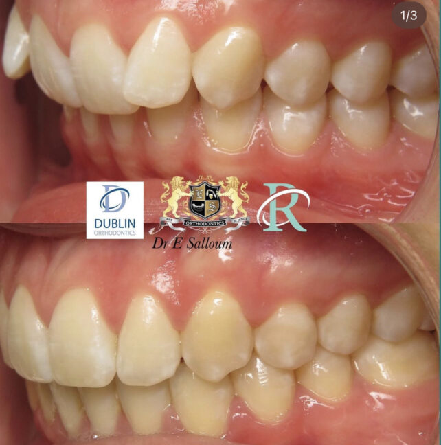 Before - Dr Erfan Salloum