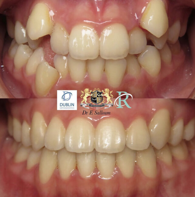Before - Dr Erfan Salloum
