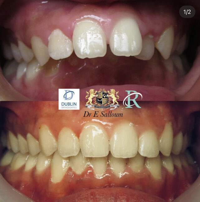 Before - Dr Erfan Salloum