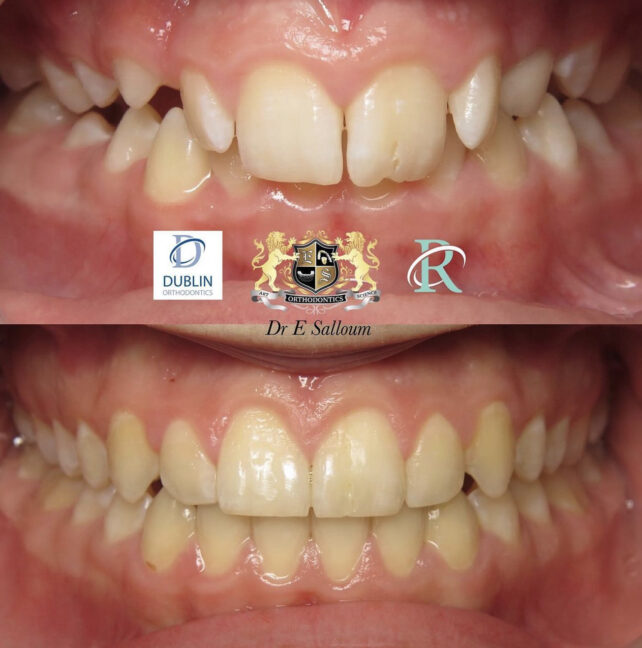 Before - Dr Erfan Salloum