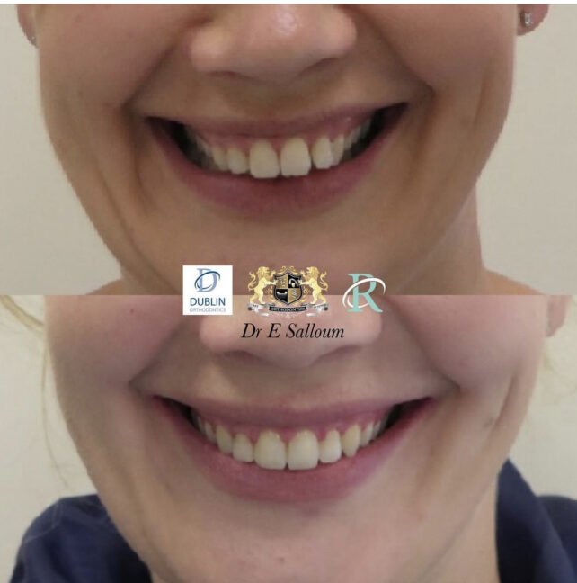 Before - Dr Erfan Salloum