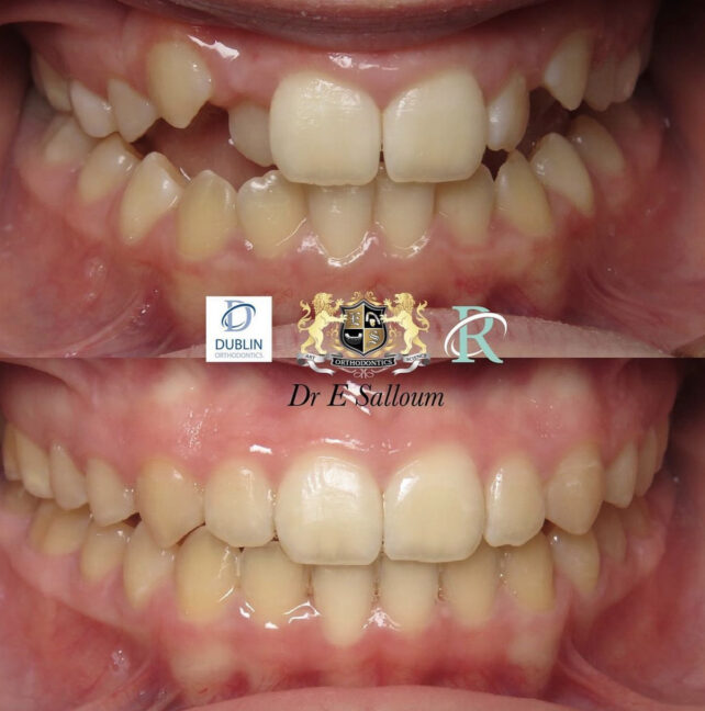 Before - Dr Erfan Salloum