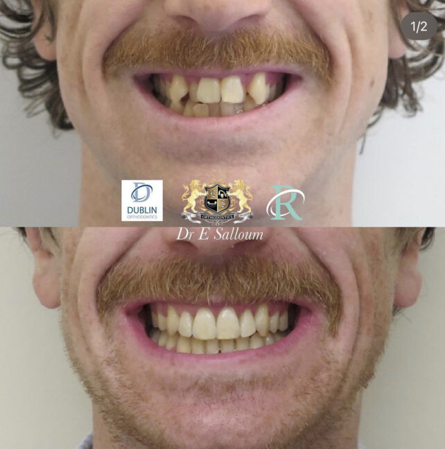 Before - Dr Erfan Salloum