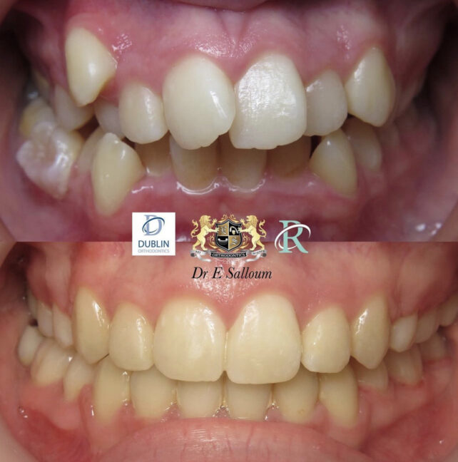 Before - Dr Erfan Salloum