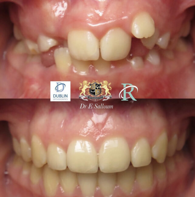 Before - Dr Erfan Salloum