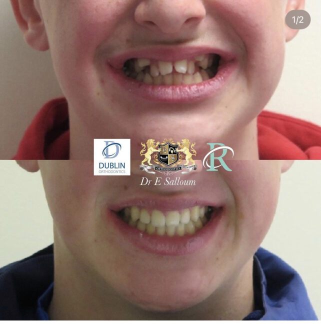 Before - Dr Erfan Salloum