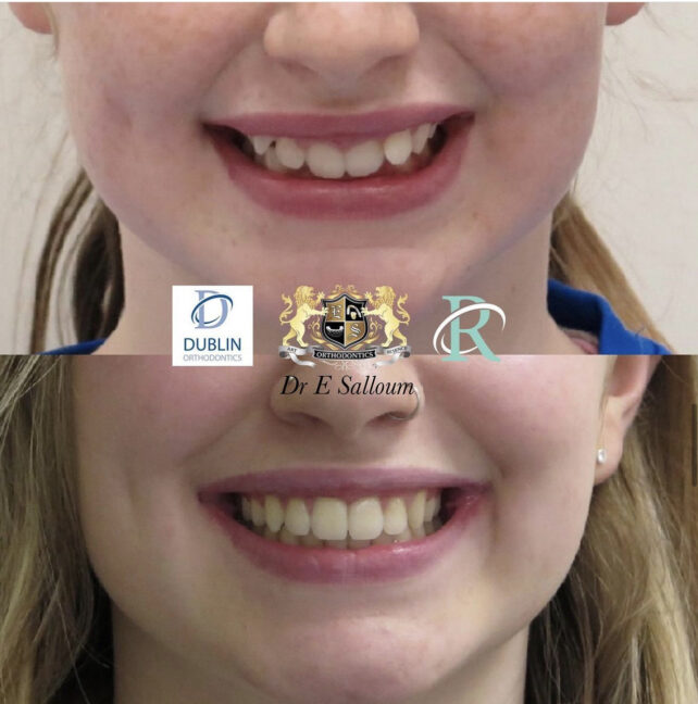 Before - Dr Erfan Salloum