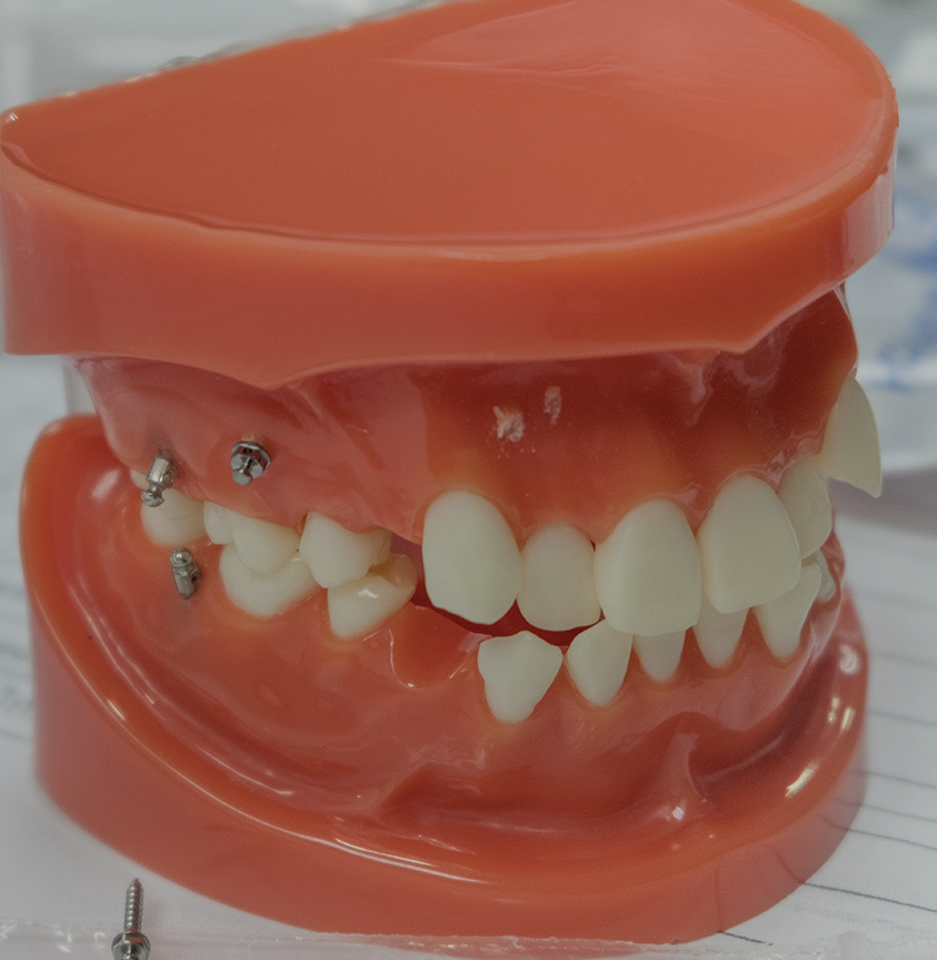 Treatment - Dr Erfan Salloum