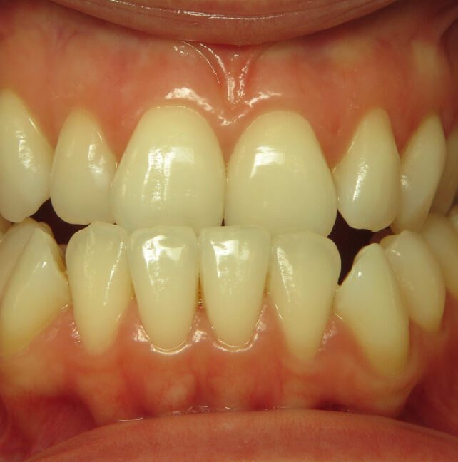 Blog - Dr Erfan Salloum