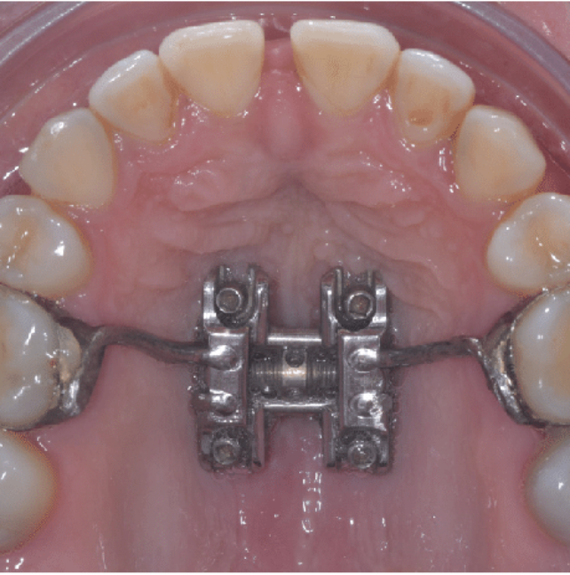 Blog - Dr Erfan Salloum