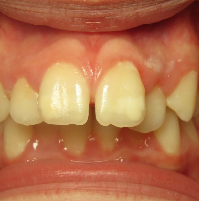 Blog - Dr Erfan Salloum
