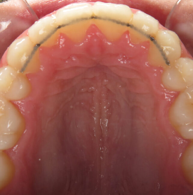 Blog - Dr Erfan Salloum