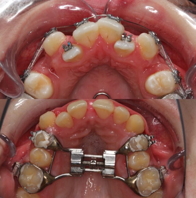 Blog - Dr Erfan Salloum
